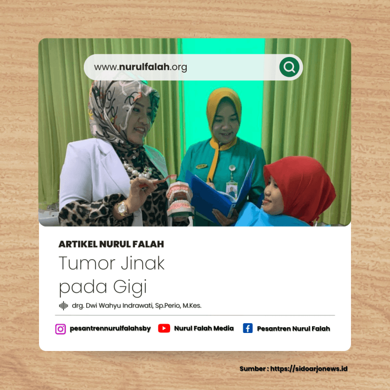 tumor-jinak-pada-gigi